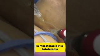 Rejuvenecimiento facial y corporal Fisioterapia Dermatofuncional🤩 [upl. by Ezara858]