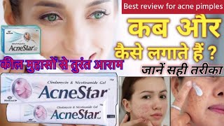 Acnestar gel for acne pimples कील मुंहासों से तुरंत आराम असरदार दवाई youtubeviralvideo ytvideo [upl. by Mairam]