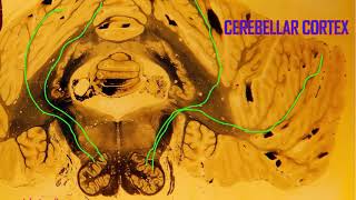 Purkinje cells in the cerebellum [upl. by Harness]