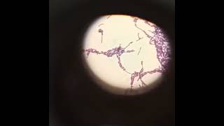 Bacillus cereus credit howtodooptinochainanalysis biology microscope scienceاكسبلور [upl. by Carisa]