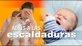 Las escaldaduras en los bebés  síntomas causas y soluciones [upl. by Gewirtz121]