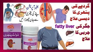 Gurdy Ki Pathri Kidney Stone Pity Ki Pathri Ka Ilaj Fatty liver Ka ilaaj [upl. by Lhamaj468]