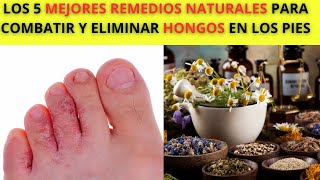 LOS 5 MEJORES remedios Caseros para COMBATIR los HONGOS en los Pies [upl. by Nhoj]