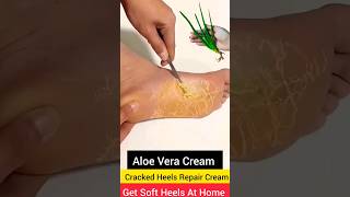 Cracked Heels Repair Home Remedy  shorts crackedheels pedicure softheels skincare ytshorts [upl. by Fredela1]