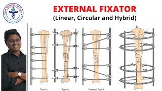 External Fixator  Lecture 07  Orthopedics [upl. by Gold343]