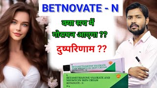 Betnovate n Cream honest review  Betnovate n lagane se kya hota hai  Betnovate n skin cream  aqh [upl. by Norbel]