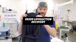 Vaser Liposuction Recovery [upl. by Barlow]