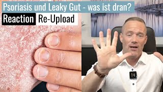 Schuppenflechte ist heilbar durch einen gesunden Darm sagt er  Reaction  ReUpload [upl. by Ahsieni]