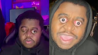 Man Jokingly Rants About Eye Popping Problems [upl. by Odine653]