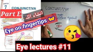 Eye lectures 11 Ptergium fibrovasular connective tissue of conjunctiva conjunctivitis eye [upl. by Adriene]