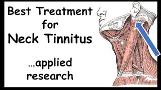 Best Treatment for NeckTinnitus  Somatictype [upl. by Noryv875]