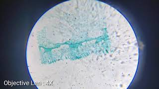 Penicillium Paracemium Under Microscope [upl. by Sink770]