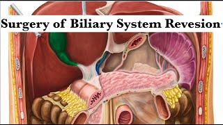 Surgery of Biliary System Revesion by ASM Minds Team [upl. by Kurth]