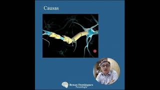 Mielite Transversa  causas diagnóstico e tratamento [upl. by Mccarthy503]