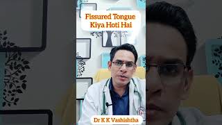 Fissured Tongue kiya hoti hai healthcare medical knowledge healthtips doctor diabetes [upl. by Kimble]