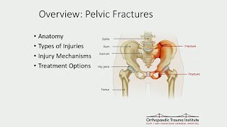 Treatment of Common Geriatric Fractures Spine and Pelvis [upl. by Baldridge]