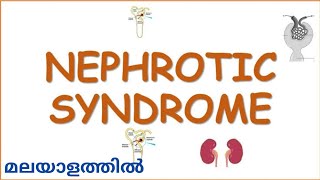 NEPHROTIC SYNDROME overview in Malayalam  Medical Surgical Nursing  Mr Nurse Manglish [upl. by Estey]