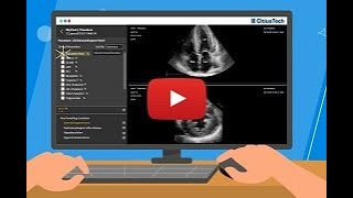 Transforming Imaging Workflows with FHIR  CitiusTechs Integrated Viewer [upl. by Ennahoj137]