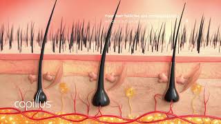 How Hair Loss Occurs and How to Help Stop It [upl. by Atiuqihs]