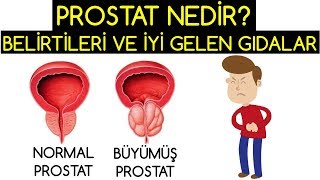 PROSTAT NEDİR BELİRTİLERİ VE TEDAVİ EDEN GIDALAR [upl. by Durand848]