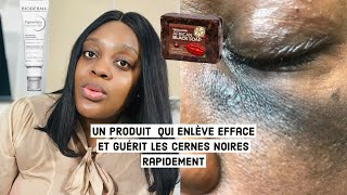 COMMENT ENLEVER  ÉCLAIRCIR ET FAIRE DISPARAÎTRE LES CERNES NOIRS RAPIDEMENT  Angele DE GIDES [upl. by Ocsirf]