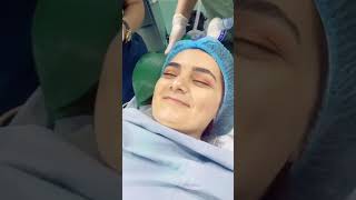 General Anesthesia Propofol Induction [upl. by Layney620]