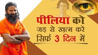 सिर्फ 3 दिन में करें पीलिया को जड़ से ख़त्म  Swami Ramdev [upl. by Hahn]