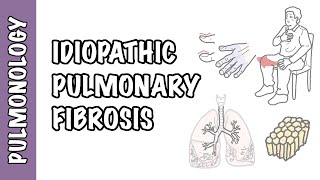 Idiopathic Pulmonary Fibrosis  pathophysiology signs and symptoms investigation and treatment [upl. by Blaine]