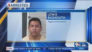 Docs Assault leaves man with partially amputated nose 1 charged [upl. by Holbrook558]