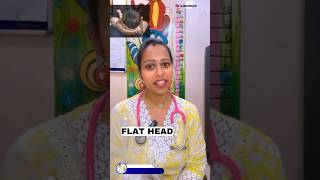 FLAT HEADhealth baby parentingtips childcare newborncarehealthybaby childdevelopment vizag [upl. by Neit630]