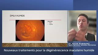 Nouveaux traitements pour la dégénérescence maculaire humide [upl. by France486]