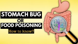 How to Tell if You Have a Stomach Bug or Food Poisoning A Complete Guide [upl. by Maryly]