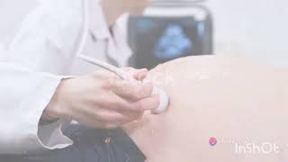 First trimester pregnancy ultrasound [upl. by Omrelliug]