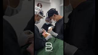 Eyebag Removal Surgery [upl. by Bainbridge]