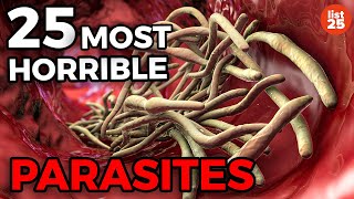 25 Parasites You Do Not Want To Be Infected With [upl. by Kele503]