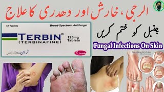 terbin ds tablet uses in urdu  Hindi  Terbinafine tablet Ky fayde  how to use terbin 125mg tablet [upl. by Calley]