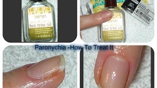 Acute Chronic PARONYCHIA Treatments [upl. by Nomrah]