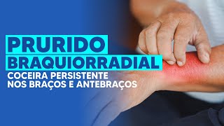 PRURIDO BRAQUIORRADIAL  DEPOIMENTO  Coceira perturbadora nos braços e antebraços [upl. by Nowd]