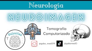 Neuroimagen  Tomografía Computarizada [upl. by Adlihtam]