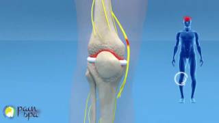 COOLIEF Genicular nerve block and radiofrequency of the Knee Joint [upl. by Andert]