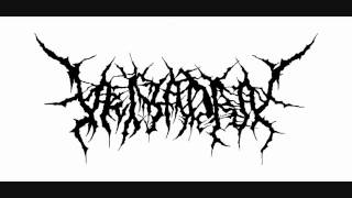 【Veiyadra】 Putrid Infection→Sanguineous Mortuary Brutal Death Metal [upl. by Ardrey]