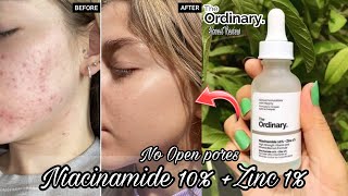 The Ordinary Niacinamide 10 Zinc 1  How To use The Ordinary Niacinamide Serum Correctly [upl. by Aleacim]