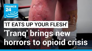 It eats up your flesh Tranq the new drug worsening Americas opioid epidemic • FRANCE 24 [upl. by Abagael857]