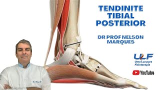 TENDINITE  TIBIAL POSTERIOR  Dr Prof Nelson Marques [upl. by Neelrahs]