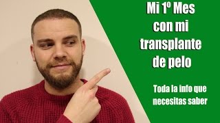 Mi 1º mes con mi trasplante de pelo Información cómo dormir prohibiciones y consejos [upl. by Ezarra]