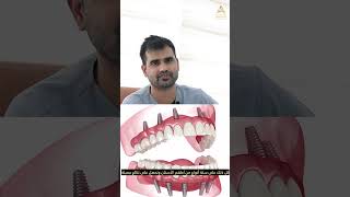 Dentures vs Implants Smile Restoration for Edentulous Patients [upl. by Strohben]