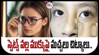 స్పెట్స్ వల్ల ముక్కుపై మచ్చలు చిట్కాలు  Tips for spots on nose caused by spets  MAHI MEDIA [upl. by Valeta977]