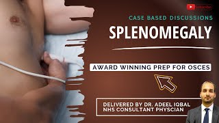 Splenomegaly  Abdominal  BEST OSCE Preparation for Medical Student Exams [upl. by Arihat]