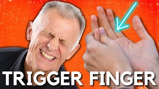 Top 3 Ways to Treat Trigger Finger or a Snapping Finger or Thumb [upl. by Wilscam]