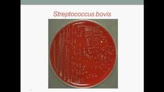 Bacteriology Streptococcus Gram Positive Cocci [upl. by Erleena]